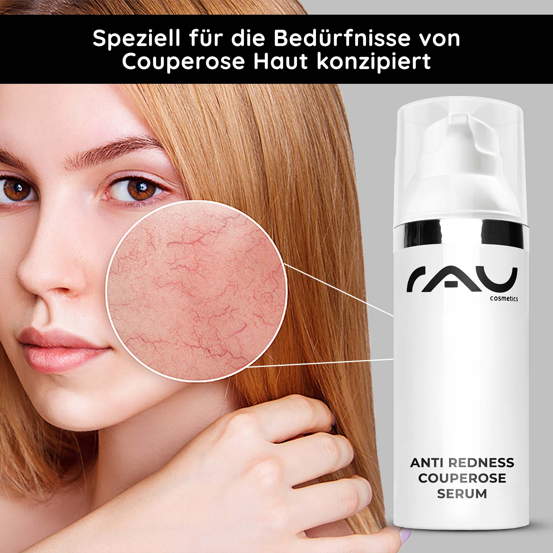 Anti Redness Couperose Serum 50 ml bei Rosacea - wirkt Rötungen entgegen Frau mit blonder Haar und betontem roten Hautbereich, RAU Cosmetics Anti Redness Couperose Serum im Vordergrund, speziell für Couperose-Haut entwickelt.