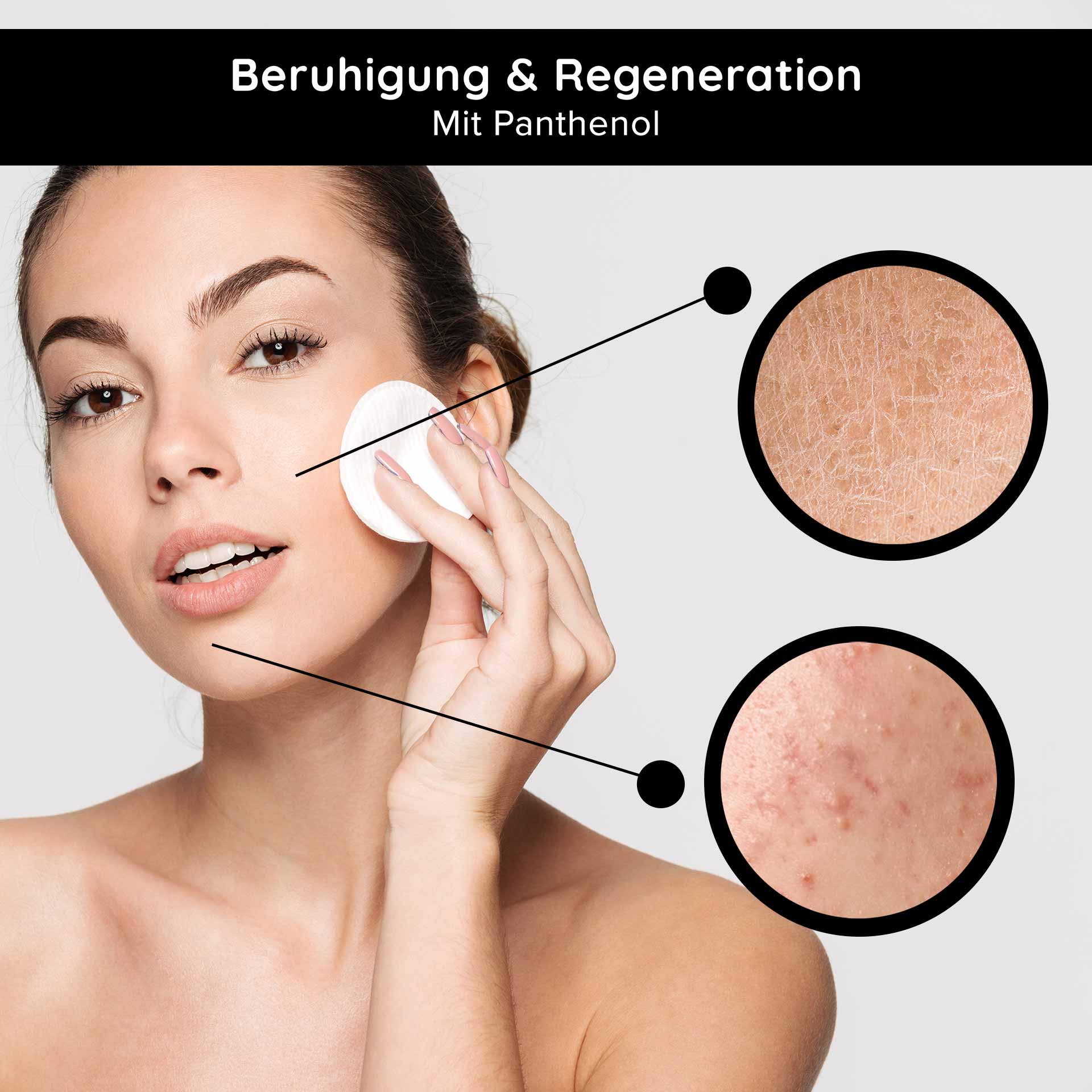 Caviar 24h Cream 200 ml Hautpflege mit Caviar Extrakt Frau mit Wattepad auf der Haut, zeigt beruhigende und regenerierende Wirkung von Panthenol, Hautprobleme wie Trockenheit und Unreinheiten im Fokus.