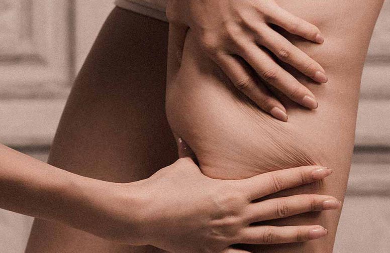 rau--cosmetics-lipodem-02 rau--cosmetics-lipodem-02