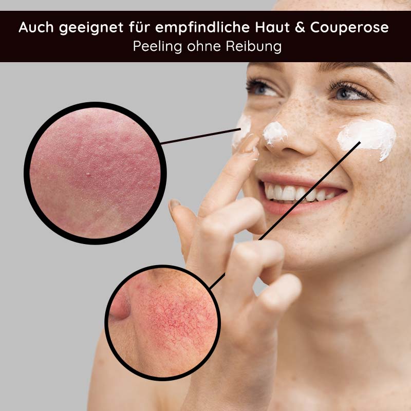 Fruit Acid Peeling 100 ml Fruchtsäurepeeling mit BHA