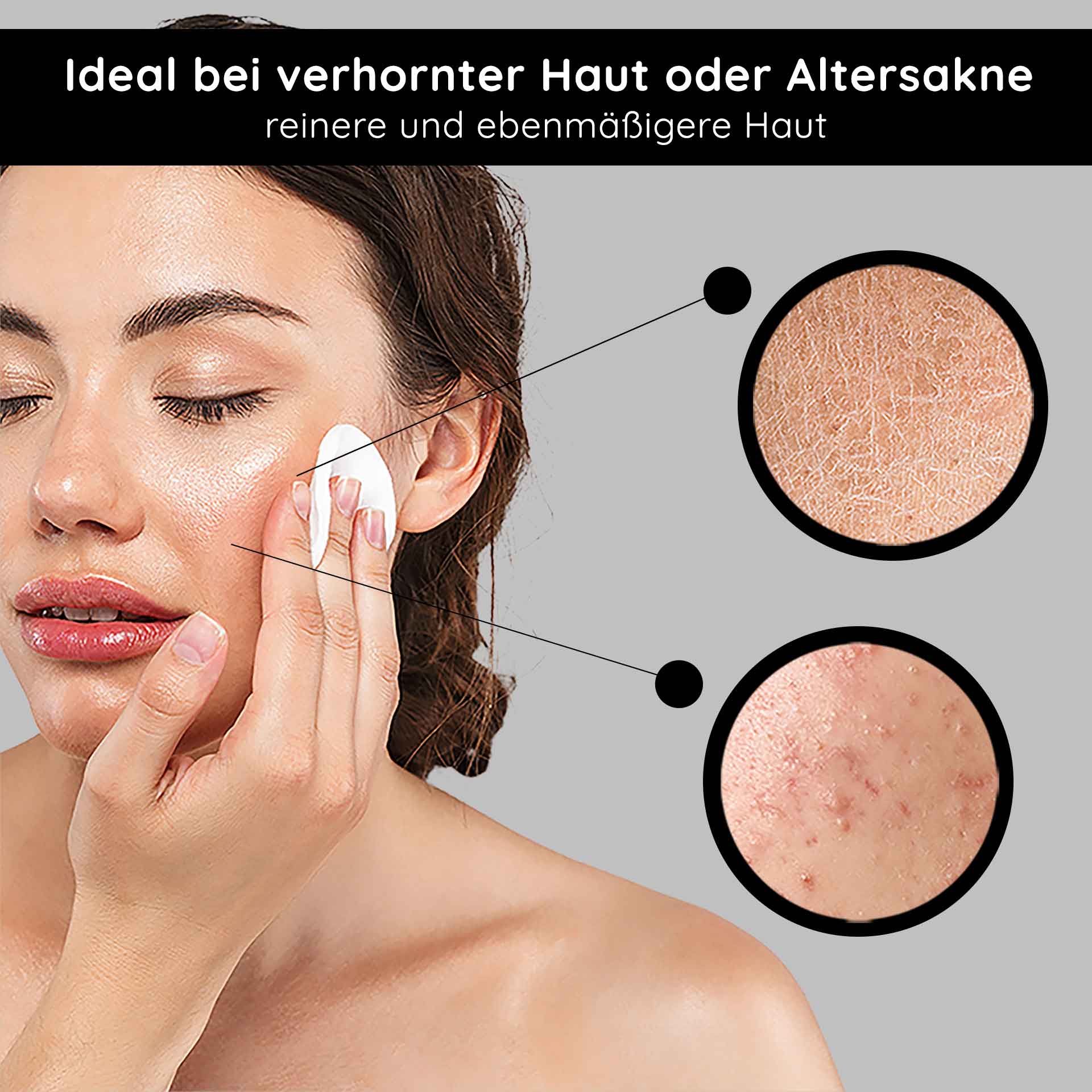 아하 토닉 1000ml 순한 과일 산성 토닉 Frau mit Wattepad, das AHA Tonic auf Gesicht aufträgt, ideal bei verhornter Haut oder Altersakne, zeigt Hautunreinheiten und Texturverbesserung.