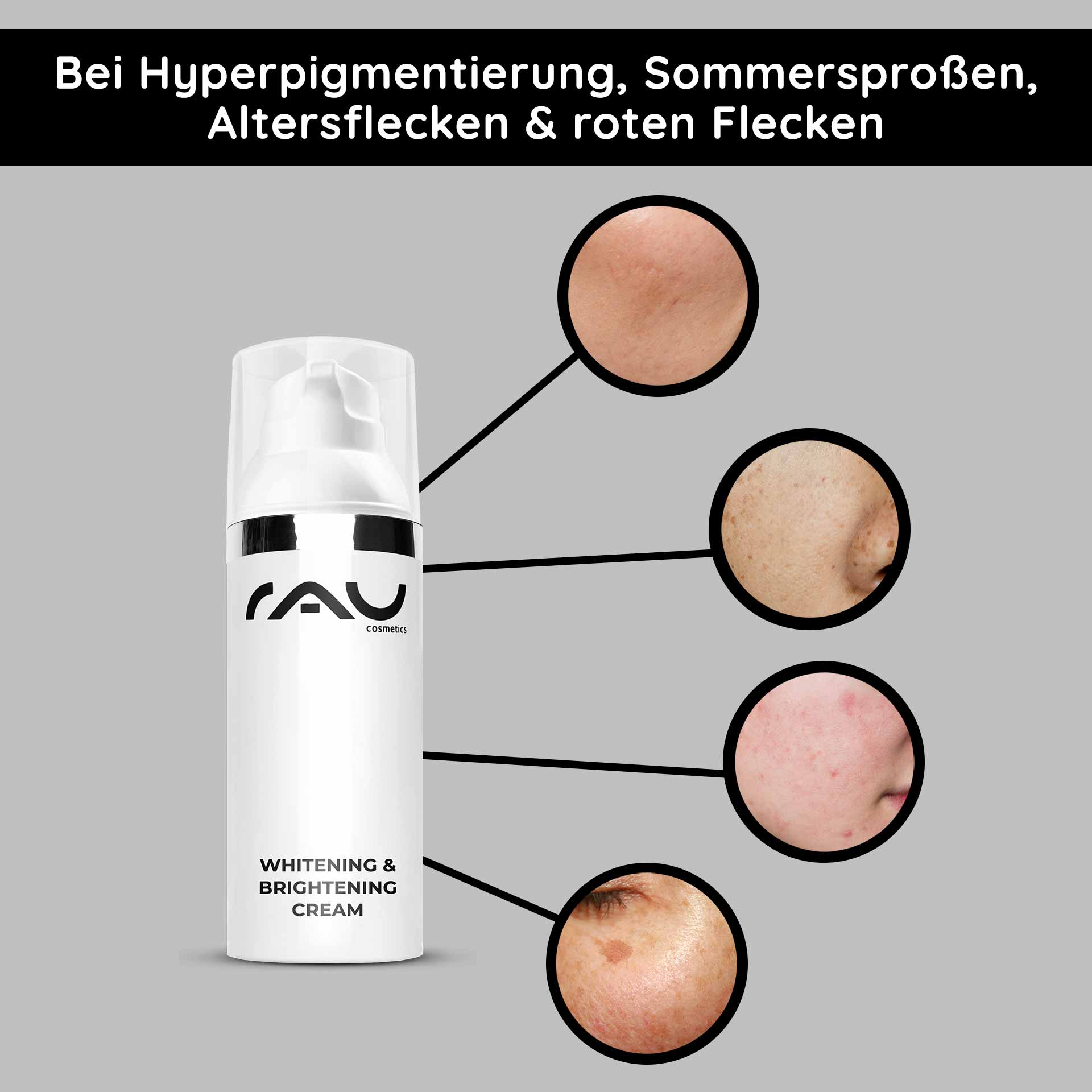 Whitening & Brightening Cream 50 ml Hautaufheller Die Whitening & Brightening Cream von RAU Cosmetics hebt Hautunreinheiten wie Hyperpigmentierung, Altersflecken und rote Flecken hervor und zeigt wirksame Lösungen zur Hautaufhellung.